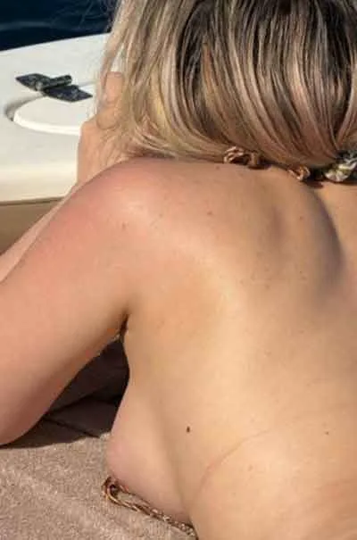 Hanne, 35 år