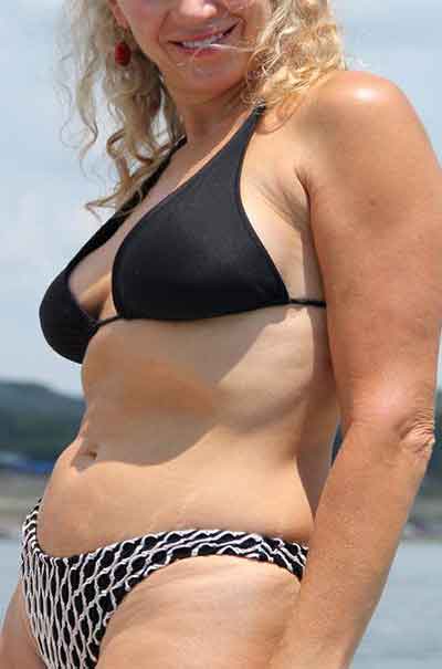 Anette, 37 år